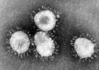 Mikroskopi bilde av Coronavirus hentet fra Wickipedia